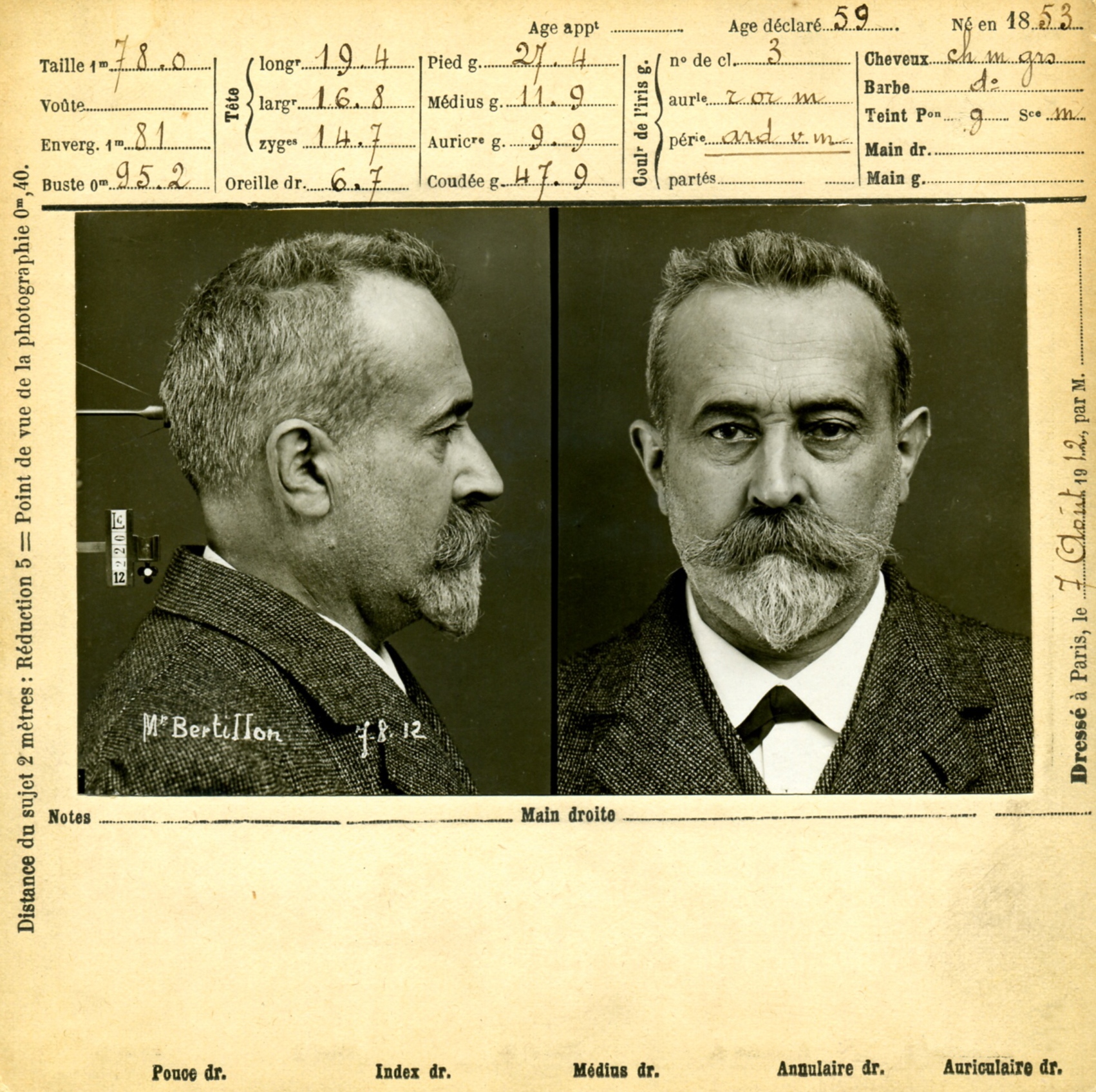 A mugshot of Alphonse Bertillon, showing a front and side view of his face, along with anthropometric measurements